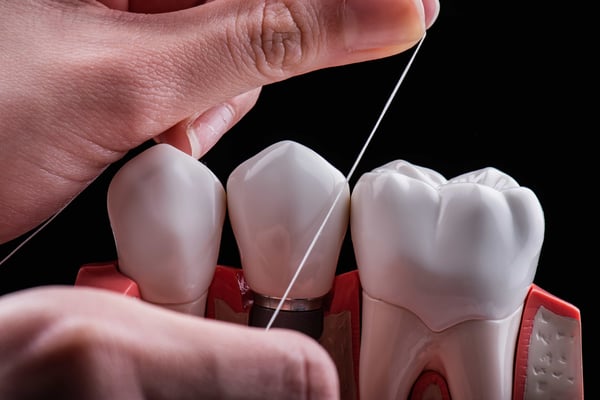 使用牙線預防牙周病