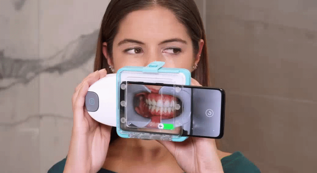 Dental Monitoring 遠距醫療